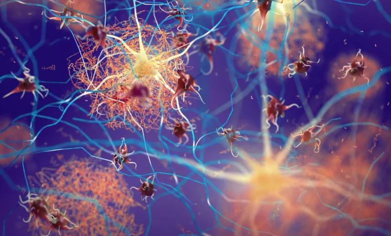 Научници откривају мождане прекидаче који чисте Алцхајмерове плакове