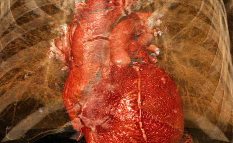 Преслушавање мозга и имунитета погоршава оштећење срчаног удара