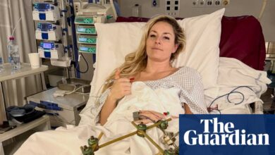 Линдзи Вон каже да успех има ‘потпуно другачије значење’ после треће операције сломљене ноге | Линдзи Вон