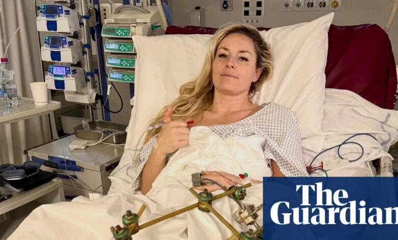 Линдзи Вон каже да успех има ‘потпуно другачије значење’ после треће операције сломљене ноге | Линдзи Вон