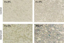 Исправка аутора: БЦЛ6 омогућава Пх+ ћелијама акутне лимфобластне леукемије да преживе инхибицију БЦР-АБЛ1 киназе