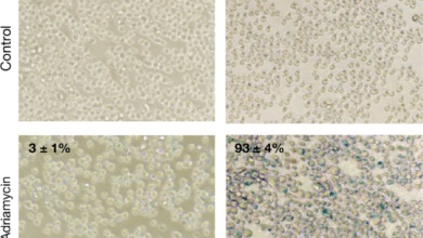 Исправка аутора: БЦЛ6 омогућава Пх+ ћелијама акутне лимфобластне леукемије да преживе инхибицију БЦР-АБЛ1 киназе