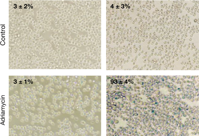 Исправка аутора: БЦЛ6 омогућава Пх+ ћелијама акутне лимфобластне леукемије да преживе инхибицију БЦР-АБЛ1 киназе