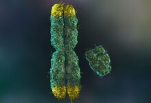 Многи мушкарци губе своје И хромозоме како старе. То им може скратити живот.