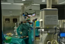 Шпанија извршила прву трансплантацију лица са донором за еутаназију