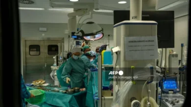 Шпанија извршила прву трансплантацију лица са донором за еутаназију