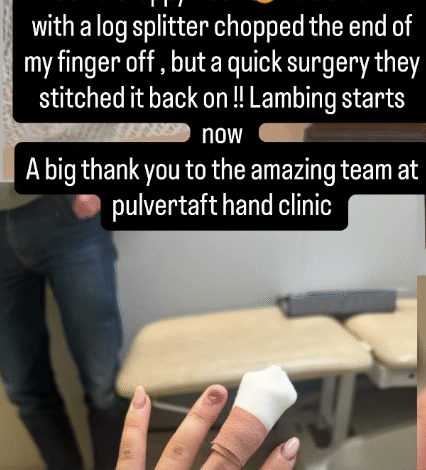 Звезда Кларксонове фарме Харијет Кауан хитно је пребачена у болницу након што је одсекла прст