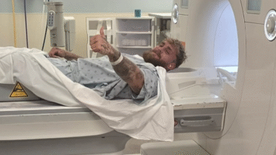 Џејк Пол има другу операцију вилице након нокаутацијом Ентонија Џошуе: ‘Шрафови се олабаве’ Џејк Пол има другу операцију вилице након нокаутацијом Ентонија Џошуе: ‘Шрафови се олабаве’