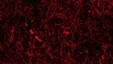 Случајно откриће наговештава мистериозне структуре у нашем мозгу