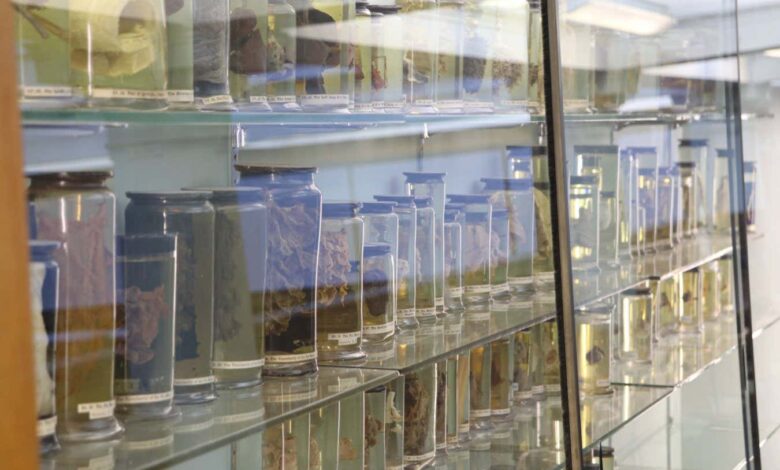 Најстарији вирус прехладе на свету пронађен у плућима жене из 18. века