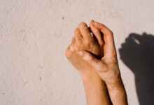 Руксолитиниб: Знаковита крема од витилига циља имуне ћелије које ометају пигментацију