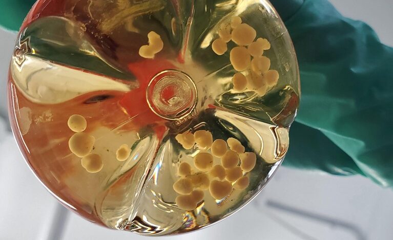 Сада није време за одузимање средстава за истраживање ткива људског фетуса Сада није време за одузимање средстава за истраживање ткива људског фетуса