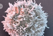 ЦАР-Т терапија пружа олакшање за децу са аутоимуним болестима