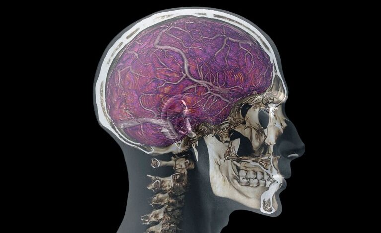 Како ‘одводи лобање’ чувају мозак од оштећења и патогена