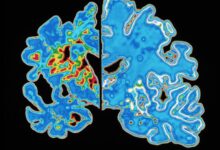 ‘Универзална’ вакцина штити мишеве од више патогена