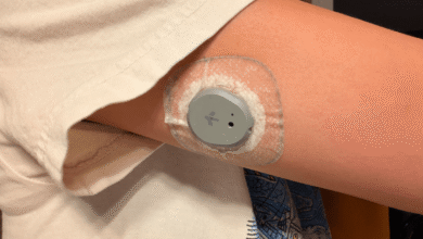 Континуирани монитор глукозе може вам помоћи да изгубите тежину (2026)
