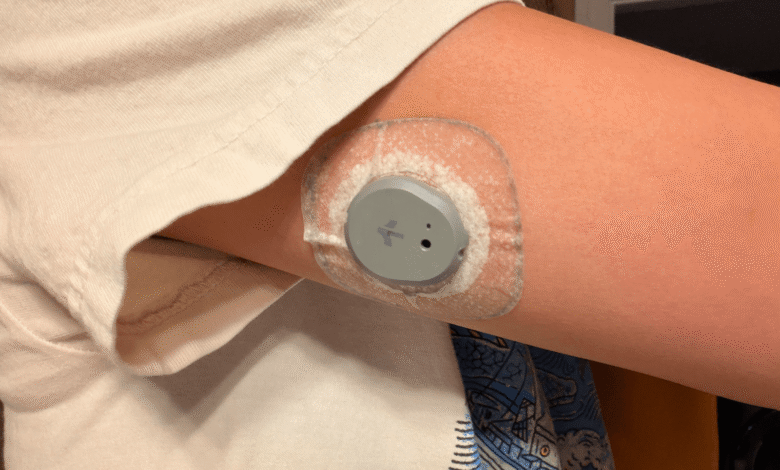Континуирани монитор глукозе може вам помоћи да изгубите тежину (2026)