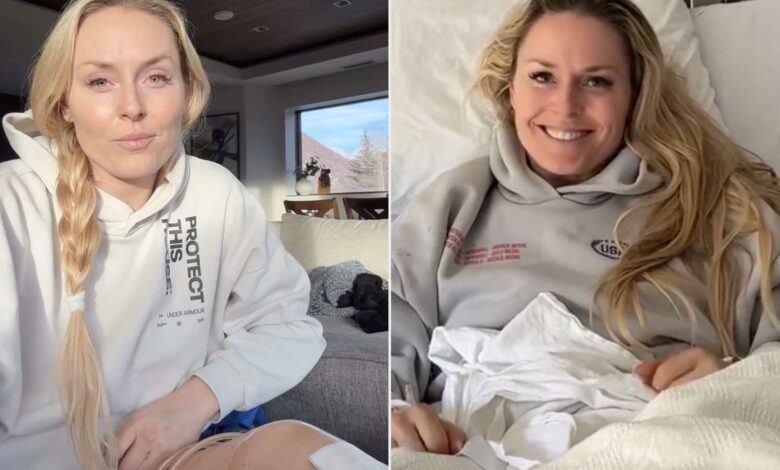 Линдзи Вон открива да јој је нога скоро ампутирана након пада на Олимпијади Линдзи Вон открива да јој је нога скоро ампутирана након пада на Олимпијади