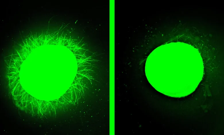 Људска кичмена мождина узгојена у лабораторији зацељује након повреде у великом пробоју
