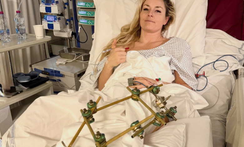 Линдзи Вон је спремна за даљу операцију сломљене ноге док објављује видео ажурирање из болничког кревета