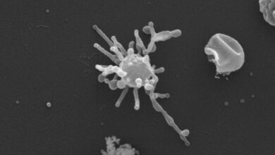 Древни микроб ‘Асгард’ је можда користио кисеоник много пре него што је био у изобиљу на Земљи, нудећи нови траг о пореклу сложеног живота Древни микроб ‘Асгард’ је можда користио кисеоник много пре него што је био у изобиљу на Земљи, нудећи нови траг о пореклу сложеног живота