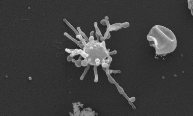 Древни микроб ‘Асгард’ је можда користио кисеоник много пре него што је био у изобиљу на Земљи, нудећи нови траг о пореклу сложеног живота